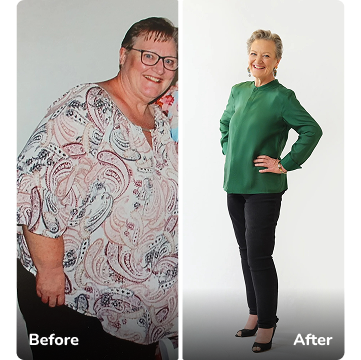 lee-before-after
